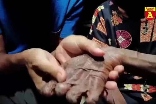 "Hãi hùng" hủ tục cắt ngón tay của bộ tộc Dani ở Indonesia