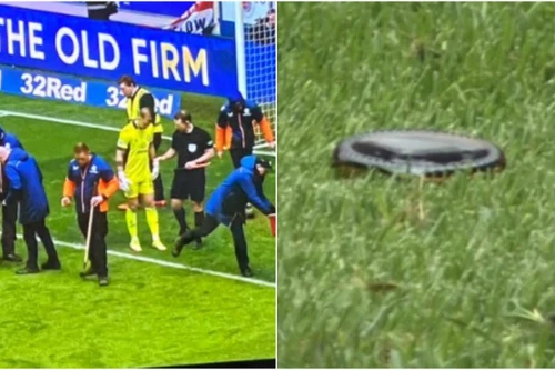 Thủ môn Joe Hart bị tấn công nguy hiểm bằng mảnh chai thủy tinh