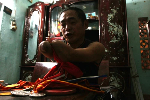 Mất 2 cánh tay, đánh bóng bàn vô địch