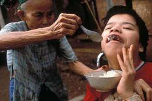 50 năm thảm họa da cam