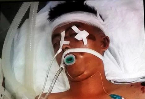 Tìm nhân thân nam thanh niên bị tai nạn nguy kịch