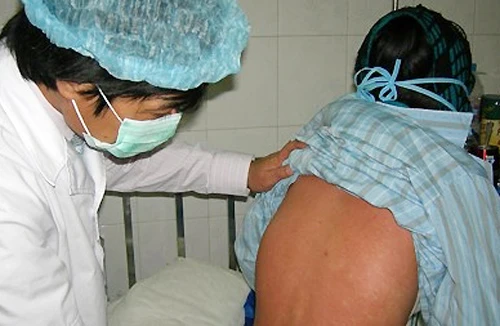 Nhiều bệnh nhân nguy kịch do côn trùng đốt