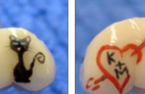 Mốt xăm lên răng của giới trẻ - Đẹp chỗ nào?