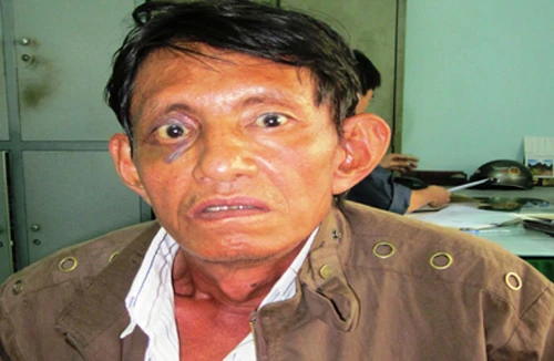 Giết người do va chạm giao thông