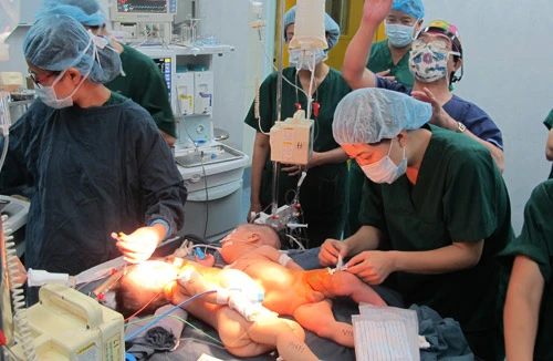 Tách rời thành công 2 trẻ sinh đôi 4 tháng tuổi