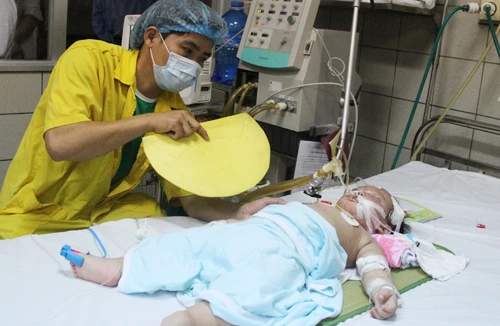 Nắng nóng, nhiều trẻ nhiễm bệnh vì nằm điều hòa