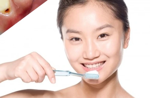 Bệnh từ miệng mà ra