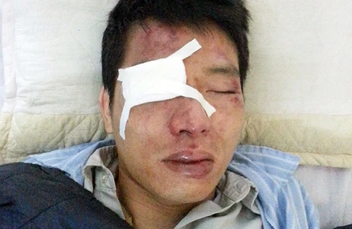 Thêm một nhân viên xe buýt bị hành hung