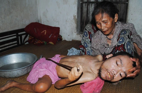 Câu chuyện một người mẹ “khất thực” nuôi con đầy cảm động 