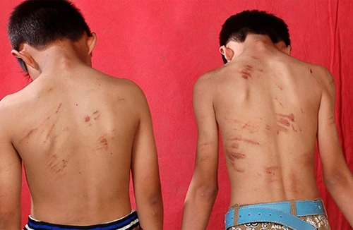 Bắt 7 đối tượng “cướp máu” trẻ em