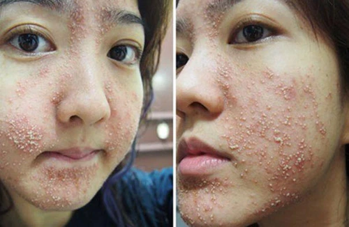 Đừng ham kem trắng da siêu tốc