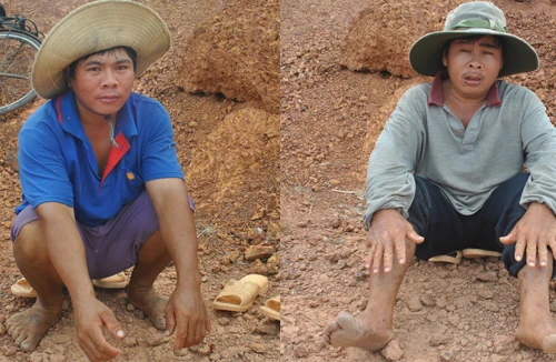 Kỳ lạ 2 anh em cùng "6 ngón", cùng sở thích giống nhau