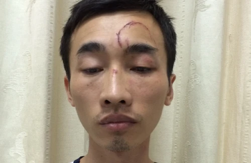 Tống tiền bạn gái bằng “ảnh nóng”