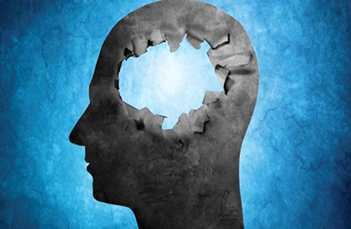 Chuyện lạ có thật về bộ não con người