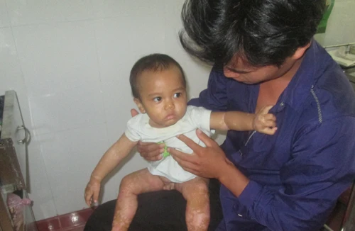 Cậu bé 1 tuổi bị bệnh lạ và những hủ tục đáng sợ