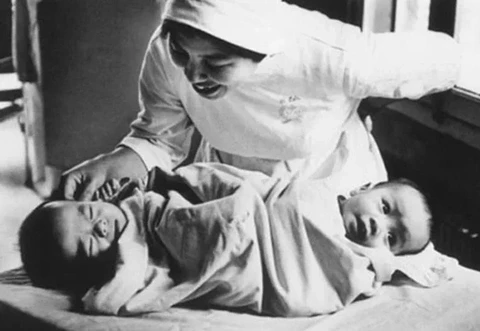 Phim tài liệu về cặp song sinh tách dính nổi tiếng chính thức ra rạp Việt Nam