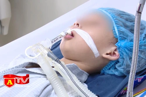 Cảnh báo trẻ bị biến chứng nặng do mắc viêm não Nhật Bản