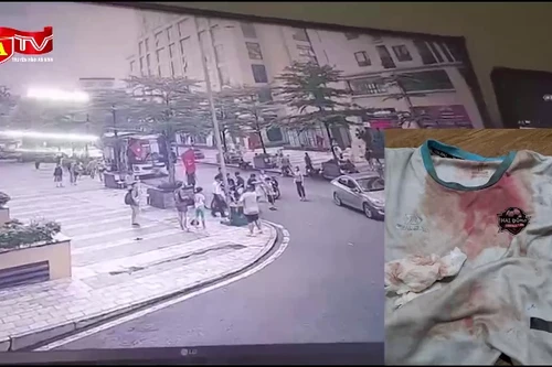 Điều tra vụ cháu bé bị hành hung trước sảnh chung cư