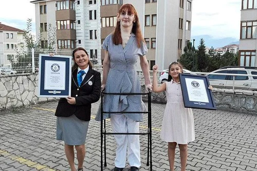 Người phụ nữ cao nhất thế giới do mắc bệnh hiếm