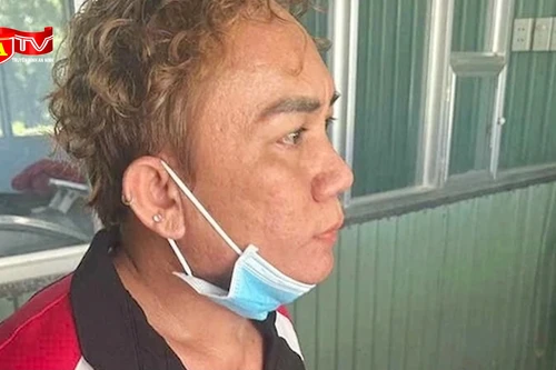 Bắt giữ ngay đối tượng điều khiển ô tô đâm thương vong thân nhân