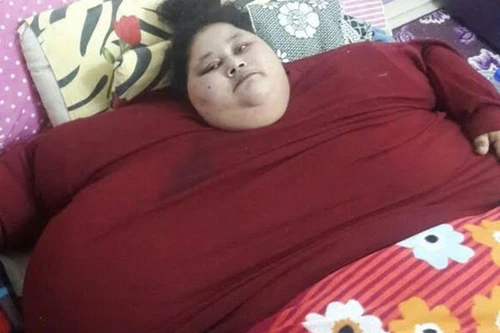 Cô gái nặng nhất thế giới chuẩn bị được phẫu thuật giảm béo tại Ấn Độ