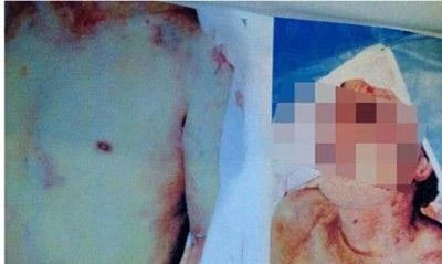 Trung Quốc: Phát hiện xác thanh niên có nghi vấn bị tra hỏi bức cung