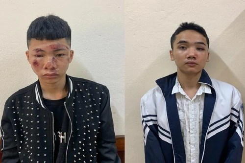 Khởi tố 2 đối tượng lao xe đâm trọng thương CSGT