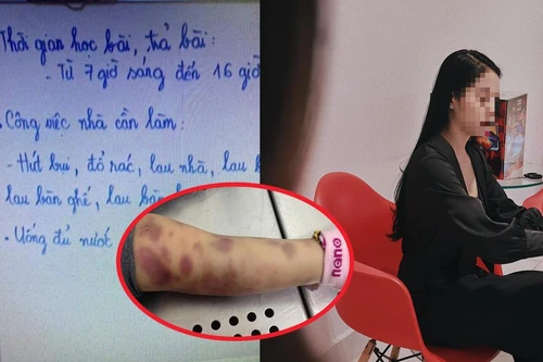 Từ vụ bé 8 tuổi bị bạo hành đến chết: Làm thế nào để nhận biết trẻ bị ngược đãi?