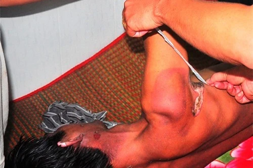  "Kẹp 3" đi trên đường trong mưa gió,1 người bị điện giật tử vong