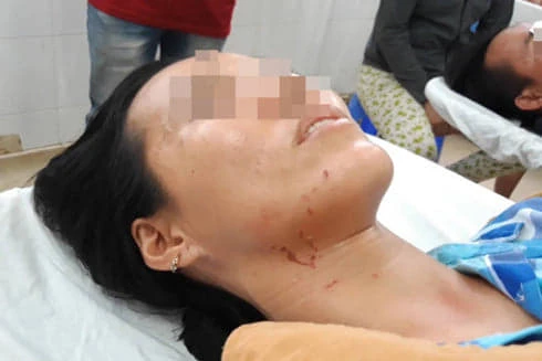 [CLIP] Những kỹ năng tự vệ cơ bản cho phụ nữ để tránh bị bạo hành