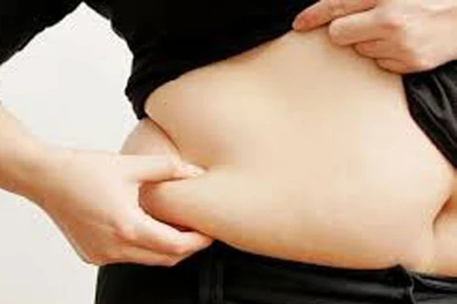 Béo phì dễ bị ung thư tuyến tụy