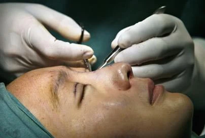 Chuyển đổi giới tính xong, liền hành nghề thẩm mỹ chui