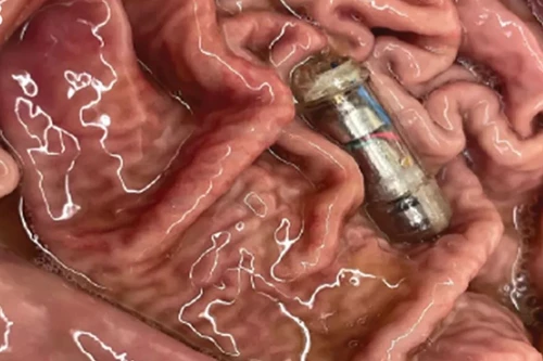 "Viên thuốc" công nghệ có khả năng tạo cảm giác no bụng