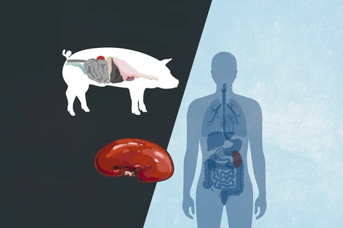 Trang trại lai tạo lợn biến đổi gen cung cấp nội tạng ghép cho con người