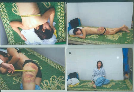 "Thòng lọng... ngọt ngào" trong vụ chồng đánh vợ tàn bạo