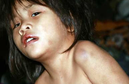 “Giải cứu bé gái 4 tuổi khỏi địa ngục trần gian”