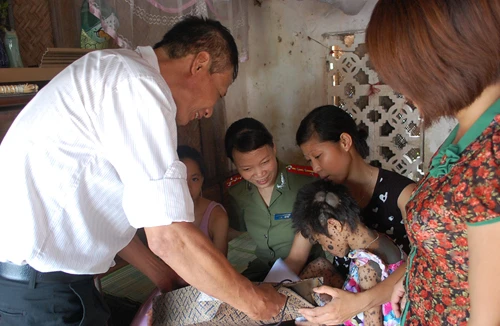 Chia sẻ với hoàn cảnh đáng thương của cháu Phạm Thị Ly