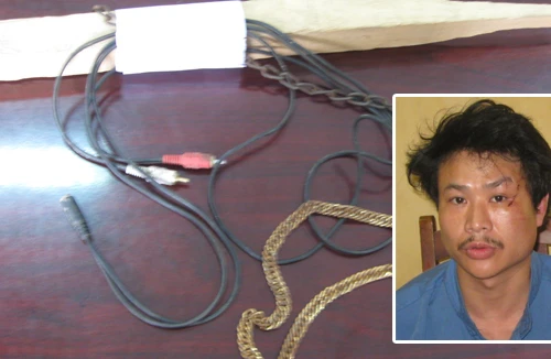 Bé gái 10 tuổi bị bố hành hạ như thời trung cổ 