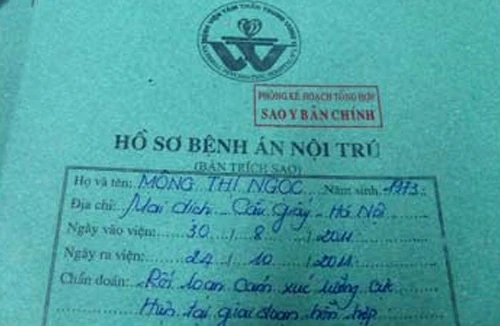 Vờ tâm thần… đi gây án 