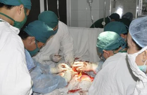 Gãy “súng” do… quá sung