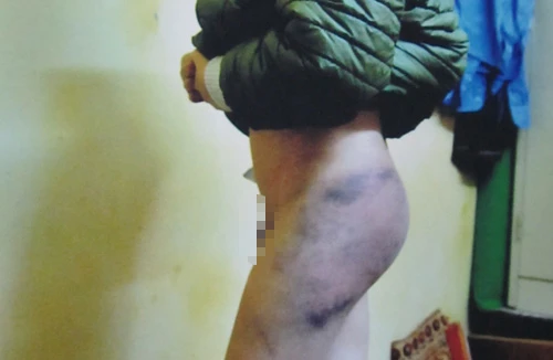 Một học sinh lớp 3 bị bạo hành?