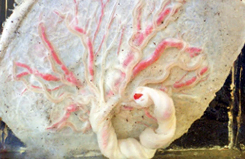 Nhau thai bà đẻ được tuồn ra ngoài bằng đường nào?