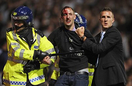 Lo nhất côn đồ sân cỏ