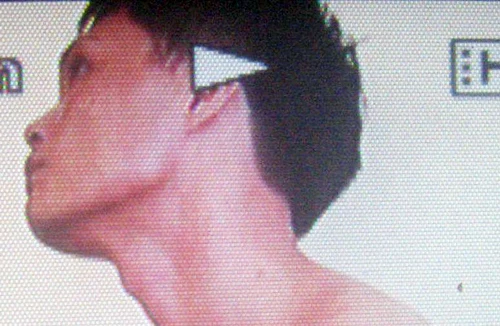 “Phê” ma túy, tự nhận là… người quá cố