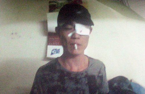 “Ăn vạ” - họa liền thân!