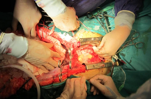 Quyết định hiến tạng sau khi chết não: Một người cứu sống 4 người 