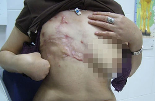 ‘‘Sởn tóc gáy” vì... làm đẹp