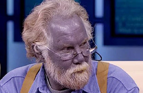 Người da xanh là có thật?