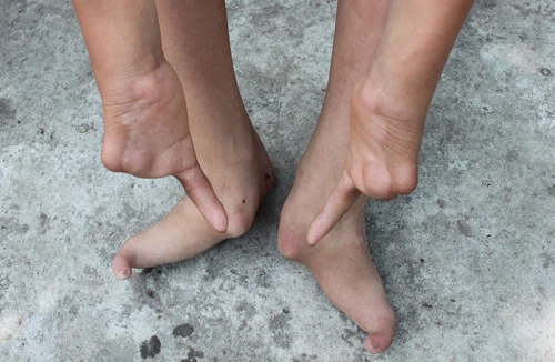 Chuyện gia đình 1 ngón