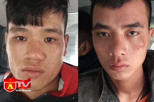 Dùng xi lanh, dao chặn đường cướp xe máy